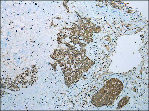 Anti-GLI2 affinity isolated antibody