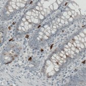 Monoclonal Anti-KIT antibody produced in mouse Prestige Antibodies® Powered by Atlas Antibodies, clone CL1667, purified immunoglobulin, buffered aqueous glycerol solution