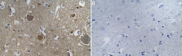 Anti-PROKR2 Antibody, clone 1J6 ZooMAb&#174; Rabbit Monoclonal recombinant, expressed in HEK 293 cells