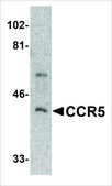 Anti-CCR5 antibody produced in rabbit IgG fraction of antiserum, buffered aqueous solution