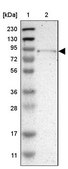 Anti-TYW1 antibody produced in rabbit Prestige Antibodies® Powered by Atlas Antibodies, affinity isolated antibody, buffered aqueous glycerol solution