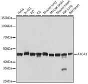 Anti-α-Actin-1 (ACTA1) Antibody, clone 8T8D0, Rabbit Monoclonal