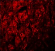 Anti-LRRTM3 antibody produced in rabbit affinity isolated antibody