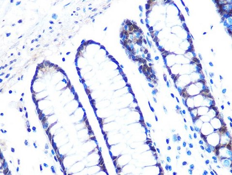 Anti-14-3-3 sigma antibody produced in rabbit