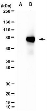 Anti-ICA 512/RESP18 Antibody, clone 1348-D29-1