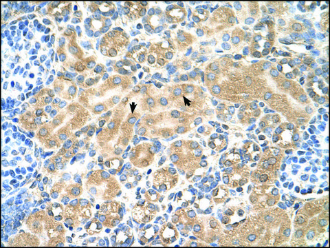 Anti-TSPAN5 affinity isolated antibody