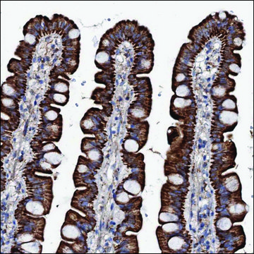 Anti-TM4SF5 antibody produced in rabbit Prestige Antibodies&#174; Powered by Atlas Antibodies, affinity isolated antibody, buffered aqueous glycerol solution