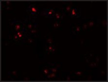 Anti-ZEB2 antibody produced in rabbit affinity isolated antibody, buffered aqueous solution
