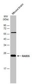 Anti-RAB35 antibody produced in rabbit affinity isolated antibody, buffered aqueous solution