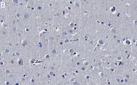 Anti-APP A4 Antibody, clone 22C11 ZooMAb® Mouse Monoclonal recombinant, expressed in HEK 293 cells