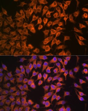 Anti-CYP17A1 Antibody, clone 5D2H1, Rabbit Monoclonal