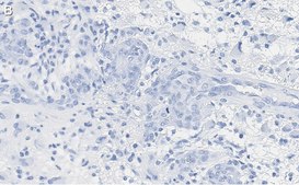 Anti-p-PTEN (Tyr240) Antibody, clone 3G6 ZooMAb® Rabbit Monoclonal recombinant, expressed in HEK 293 cells