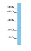 Anti-ATP6V1C1, (N-terminal) antibody produced in rabbit affinity isolated antibody