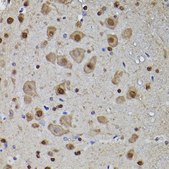 Anti-Phospho-Tau-T217 antibody produced in rabbit