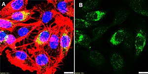 Anti-DKK1 Antibody, clone 1N16 ZooMAb® Rabbit Monoclonal recombinant, expressed in HEK 293 cells