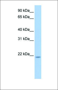 Anti-RNF5 antibody produced in rabbit affinity isolated antibody