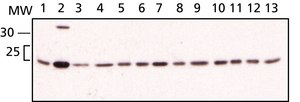 Anti-eIF4E antibody produced in rabbit ~1 mg/mL, affinity isolated antibody, buffered aqueous solution