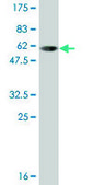 Monoclonal Anti-SULT1A1 antibody produced in mouse clone 1F8, ascites fluid