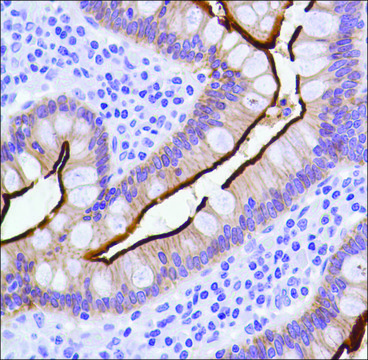 Anti-Villin antibody, Rabbit monoclonal clone SP145, recombinant, expressed in proprietary host, affinity isolated antibody