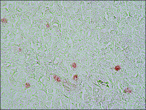 单克隆抗 增殖细胞蛋白 Ki-67 小鼠抗 clone PP-67, ascites fluid