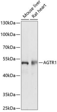 Anti-AGTR1 antibody produced in rabbit