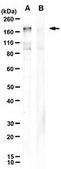 Anti-SARS-CoV-2 Spike RBD Antibody, clone 1A4-3F8