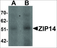 Anti-ZIP14 antibody produced in rabbit affinity isolated antibody, buffered aqueous solution