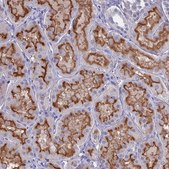 Anti-SLC2A6 antibody produced in rabbit Prestige Antibodies® Powered by Atlas Antibodies, affinity isolated antibody, buffered aqueous glycerol solution