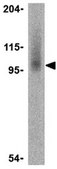 Anti-KLHL1 Antibody from rabbit, purified by affinity chromatography
