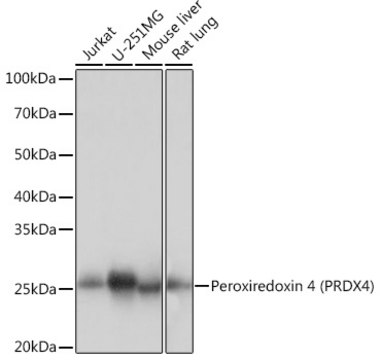 Anti-Peroxiredoxin 4 (PRDX4) Antibody, clone 9E7V0, Rabbit Monoclonal