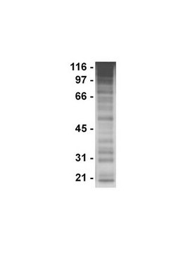 Anti-Phosphotyrosine Antibody, clone PY20 clone PY20, Upstate&#174;, from mouse