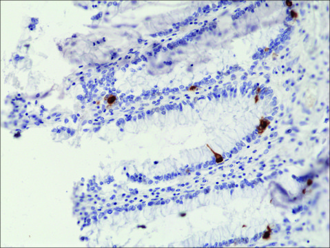 Anti-Chromogranin A antibody, Rabbit monoclonal recombinant, expressed in HEK 293 cells, clone RM385, purified immunoglobulin