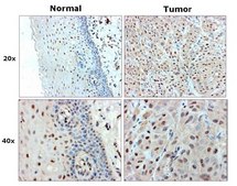 Anti-Acetylated Nucleophosmin Antibody, clone 31M1 clone 31M1, from mouse