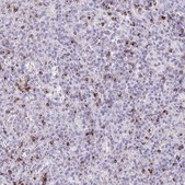 Anti-GZMK antibody produced in rabbit Prestige Antibodies® Powered by Atlas Antibodies, affinity isolated antibody, buffered aqueous glycerol solution