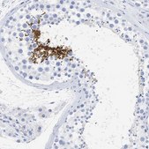 Anti-SPATA3 antibody produced in rabbit Prestige Antibodies® Powered by Atlas Antibodies, affinity isolated antibody, buffered aqueous glycerol solution