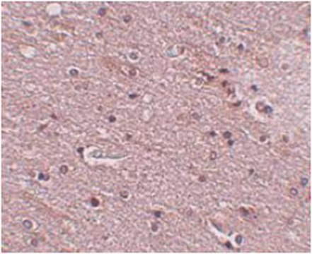 Anti-TMEM16B Antibody from rabbit, purified by affinity chromatography