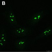 Anti-FTSJ3 Antibody, clone 3F4 ZooMAb® Rabbit Monoclonal recombinant, expressed in HEK 293 cells