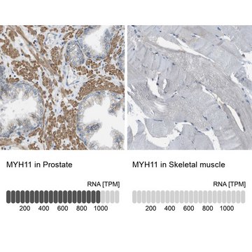 Anti-MYH11 antibody produced in rabbit Prestige Antibodies&#174; Powered by Atlas Antibodies, affinity isolated antibody, buffered aqueous glycerol solution