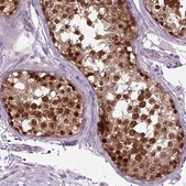 Anti-WDR48 antibody produced in rabbit Prestige Antibodies® Powered by Atlas Antibodies, affinity isolated antibody, buffered aqueous glycerol solution