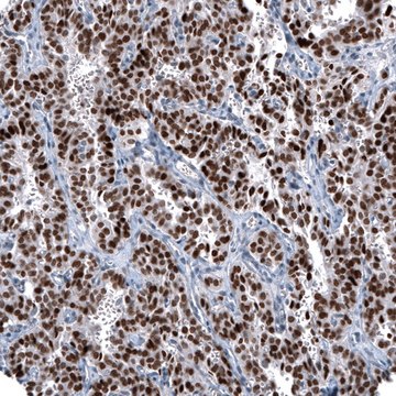 Monoclonal Anti-OTP antibody produced in mouse Prestige Antibodies&#174; Powered by Atlas Antibodies, clone CL11222, purified immunoglobulin, buffered aqueous glycerol solution