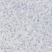 Anti-SPINK4 antibody produced in rabbit Prestige Antibodies® Powered by Atlas Antibodies, affinity isolated antibody, buffered aqueous glycerol solution