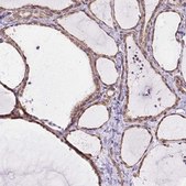 Anti-MYO5C antibody produced in rabbit Prestige Antibodies® Powered by Atlas Antibodies, affinity isolated antibody