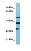 Anti-FGF13 antibody produced in rabbit affinity isolated antibody