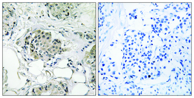 Anti-USP13 antibody produced in rabbit affinity isolated antibody