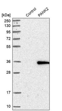 Anti-PANK2 antibody produced in rabbit Prestige Antibodies&#174; Powered by Atlas Antibodies, affinity isolated antibody, buffered aqueous glycerol solution