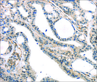 Anti-KDM5C affinity isolated antibody