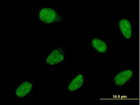 ANTI-ATOH1 antibody produced in mouse clone 3E2, purified immunoglobulin, buffered aqueous solution