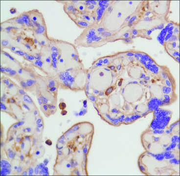 Anti-beta-Actin antibody, Rabbit monoclonal clone SP124, recombinant, expressed in proprietary host, affinity isolated antibody