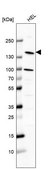 Anti-PLCB2 antibody produced in rabbit Prestige Antibodies® Powered by Atlas Antibodies, affinity isolated antibody