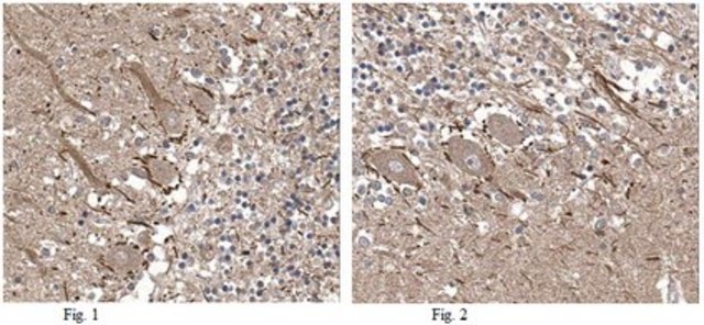 Anti-Precerebellin Antibody from rabbit, purified by affinity chromatography